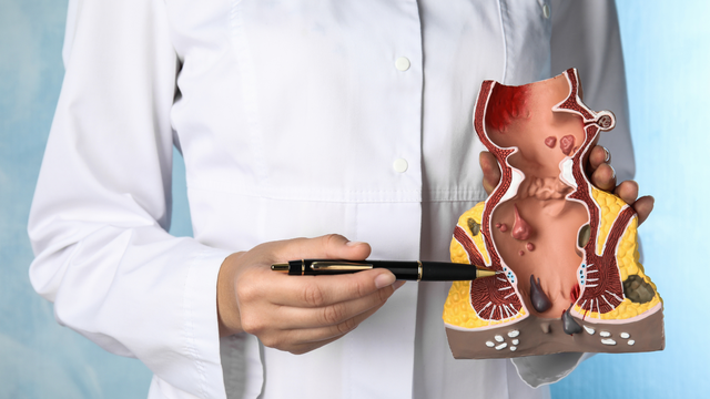 Tại sao phụ nữ thường bị trĩ sau sinh? Dấu hiệu nhận biết