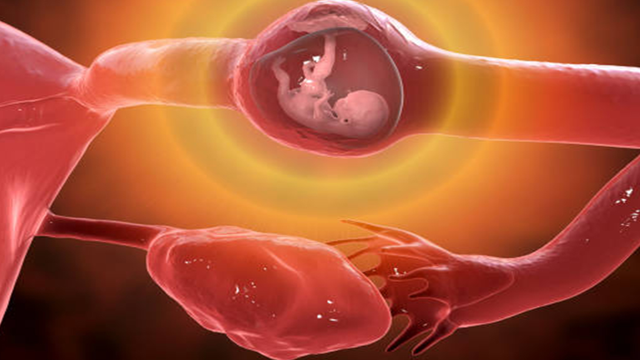 Thai ngoài tử cung mấy tuần thì vỡ? Những điều mẹ bầu cần biết