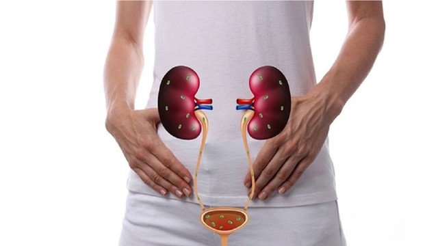 Thận ứ nước độ 1: Nguyên nhân, triệu chứng, chẩn đoán và cách điều trị