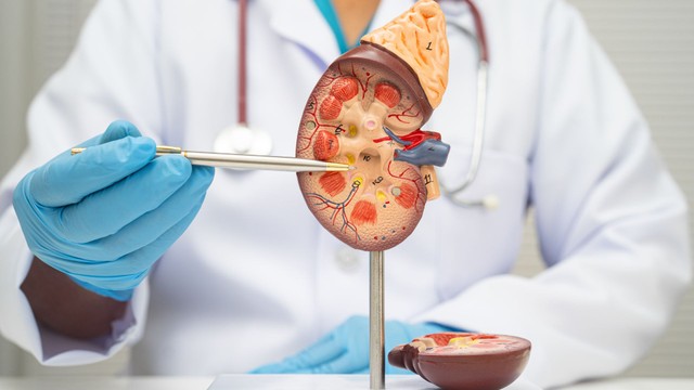 Thận ứ nước độ 2 là gì? Mức độ nguy hiểm và cách xử trí