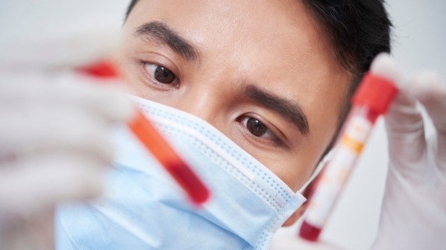 Thiếu máu hồng cầu nhỏ: Nguyên nhân, dấu hiệu và cách điều trị