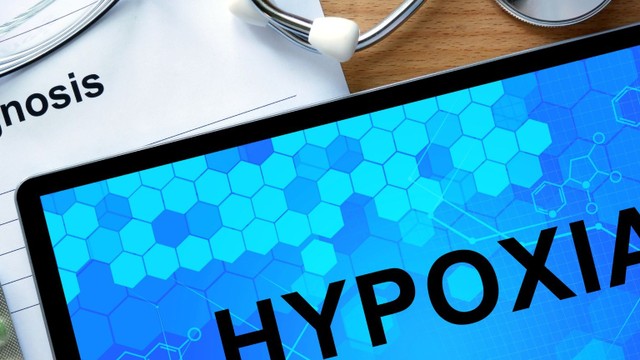 Thiếu oxy lên não có nguy hiểm không? Nguyên nhân khiến não bị thiếu oxy