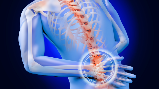 Thoát vị đĩa đệm chèn dây thần kinh: Triệu chứng và phương pháp điều trị