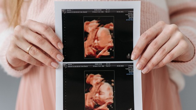 Thời điểm nào siêu âm 4D là tốt nhất? 3 mốc thời điểm mẹ bầu cần nắm