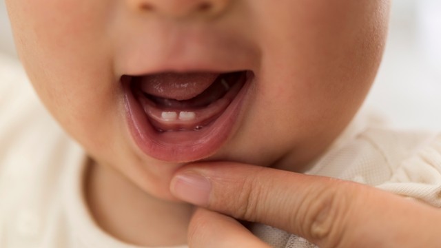 Thứ tự mọc răng của bé: Bố mẹ cần biết để chăm sóc đúng cách