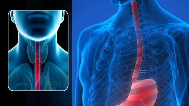 Thực quản nằm ở đâu? Chức năng, các bệnh lý liên quan thường gặp