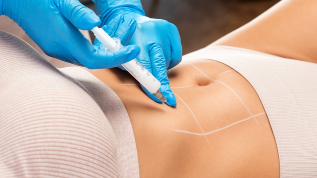 Tiêm thuốc tránh thai có kinh nguyệt không? Những thay đổi thường gặp