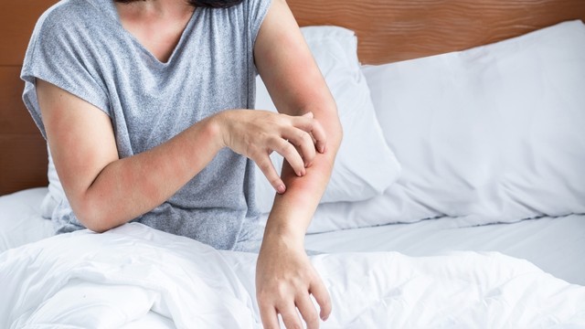 Tiền mãn kinh có bị ngứa không? Giải đáp và cách khắc phục an toàn