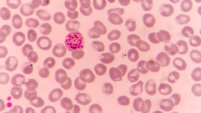 Tìm hiểu chu kỳ phát triển của ký sinh trùng sốt rét và cách ngăn chặn lây truyền