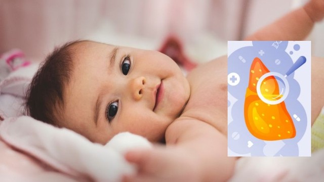 Viêm gan B ở trẻ em: Nguyên nhân, triệu chứng và cách điều trị