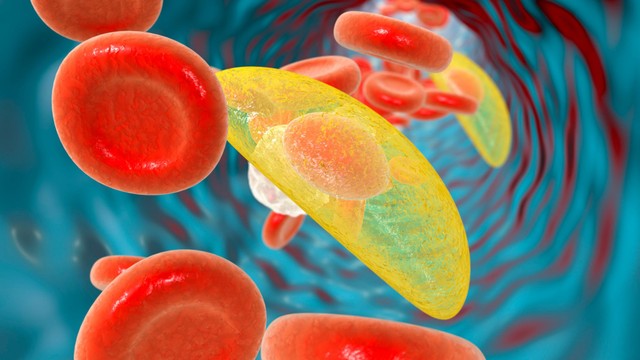 Toxoplasmosis là gì? Triệu chứng nhận biết và đối tượng có nguy cơ cao mắc bệnh