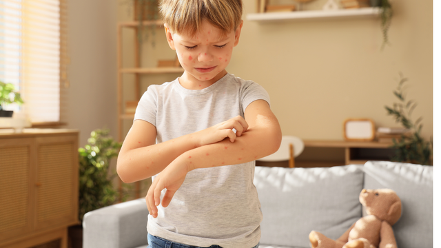 Ngứa lòng bàn tay bàn chân là bệnh gì? Nhận biết sớm để xử lý đúng
