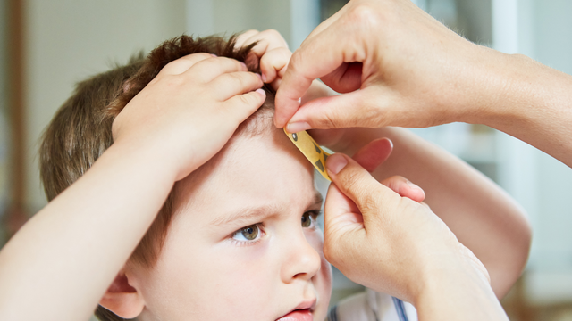 Trẻ bị té u trán phải làm sao? Cách xử lý và dấu hiệu cần đi khám ngay