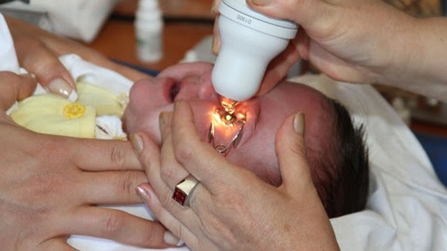 Trẻ sinh non bao nhiêu tuần thì khám mắt? Quy trình khám mắt cho trẻ