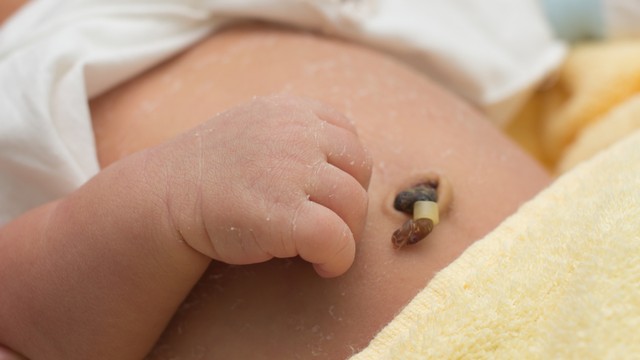Trẻ sơ sinh bao lâu thì rụng rốn? Hướng dẫn cách chăm sóc rốn cho bé đúng cách