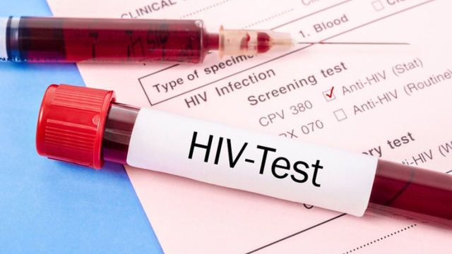 Trước khi phẫu thuật có xét nghiệm HIV không? Những điều cần biết