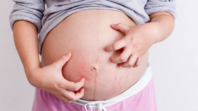 Ứ mật thai kỳ: Dấu hiệu nhận biết và cách xử lý an toàn