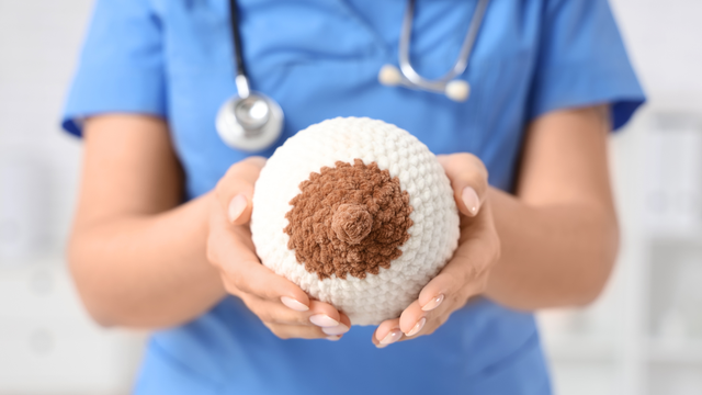 U vú lành tính có chuyển thành ác tính không? Các loại u phổ biến