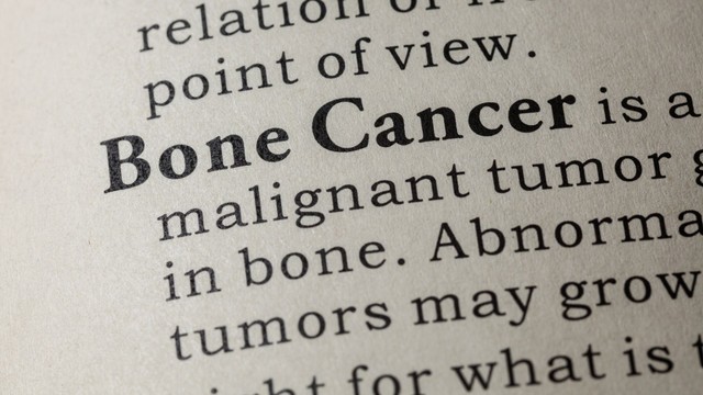 Ung thư xương giai đoạn cuối: Tiên lượng sống và hướng chăm sóc hiệu quả