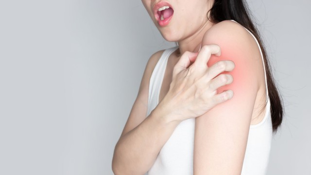 Vì sao bị ghẻ mãi không khỏi? Làm sao điều trị dứt điểm?