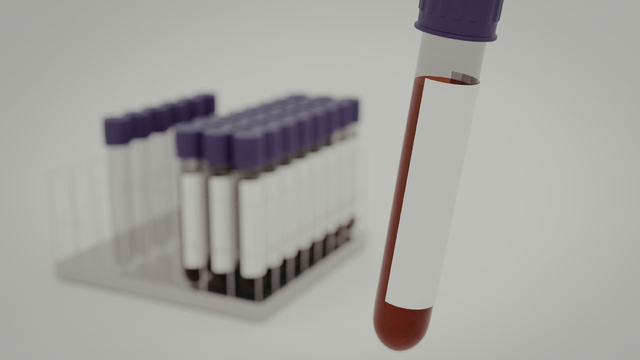 Vì sao cần xét nghiệm HCT trong sốt xuất huyết?