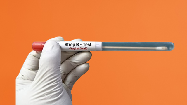 Vì sao thai phụ nên xét nghiệm liên cầu khuẩn nhóm B?