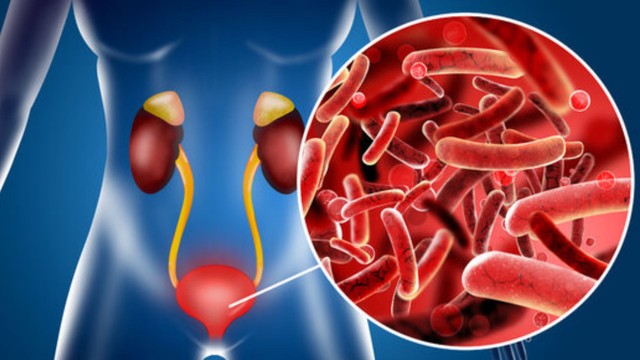 Viêm bàng quang cấp: Dấu hiệu nhận biết và cách phòng ngừa