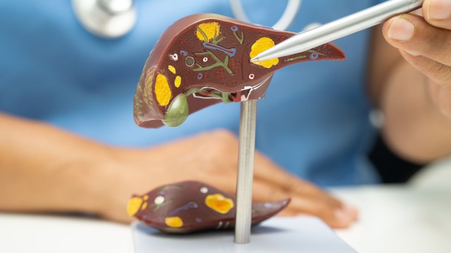 Viêm gan nào nguy hiểm nhất? 5 loại viêm gan phổ biến hiện nay