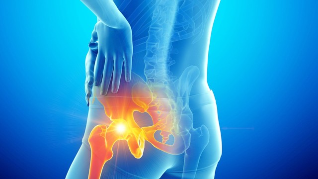 Viêm khớp cùng chậu có chữa khỏi được không và cách phòng ngừa