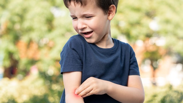 Viêm khớp ở trẻ em có nguy hiểm không? Những điều cha mẹ cần biết