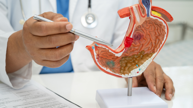 Viêm loét bờ cong nhỏ dạ dày do đâu? Nhận biết triệu chứng như thế nào?