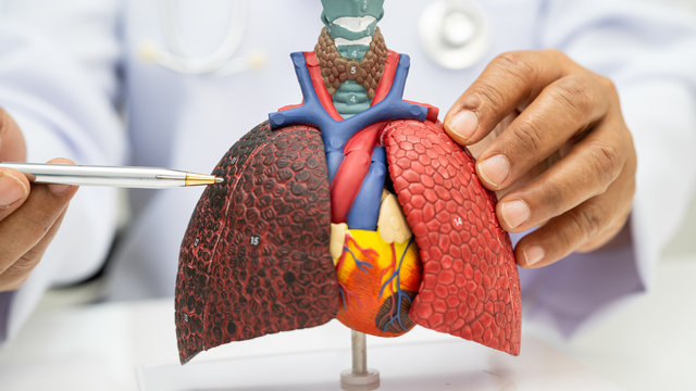 Viêm phổi kẽ là gì? Nguyên nhân, triệu chứng và phương pháp điều trị