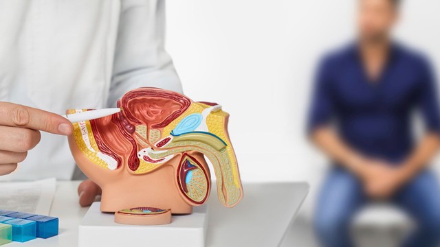 Viêm tuyến tiền liệt có gây vô sinh không? Phương pháp điều trị và phòng ngừa hiệu quả