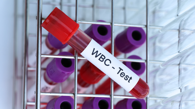 WBC trong xét nghiệm máu là gì? Những thông tin quan trọng cần biết về WBC