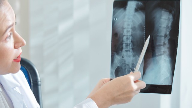 X-quang cột sống thắt lưng là gì? Khi nào cần chụp và cần lưu ý gì?