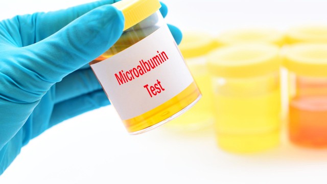 Xét nghiệm Microalbumin giúp phòng ngừa biến chứng gì?