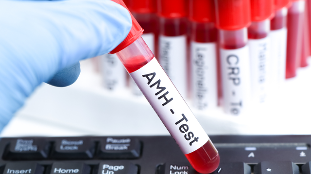 Xét nghiệm AMH có cần nhịn ăn không?