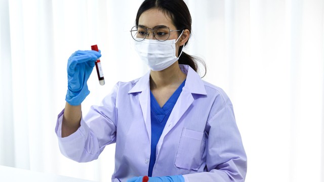 Xét nghiệm Ceruloplasmin là gì? Ý nghĩa và ứng dụng trong chẩn đoán bệnh