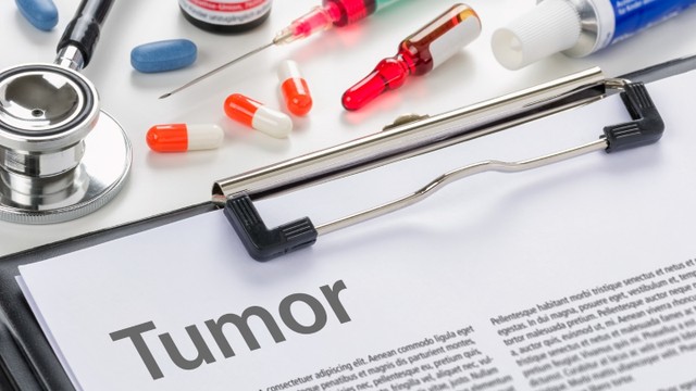 Xét nghiệm dấu ấn ung thư có chính xác không? Các lưu ý khi thực hiện xét nghiệm