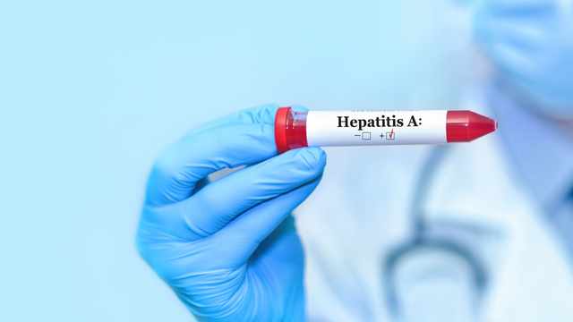 Xét nghiệm HAV là gì? Một số xét nghiệm HAV phổ biến