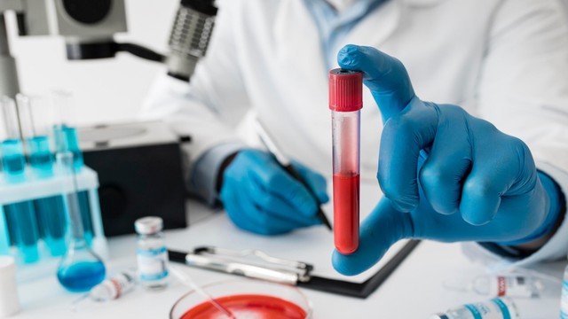 Tìm hiểu về xét nghiệm HBeAg chẩn đoán viêm gan B