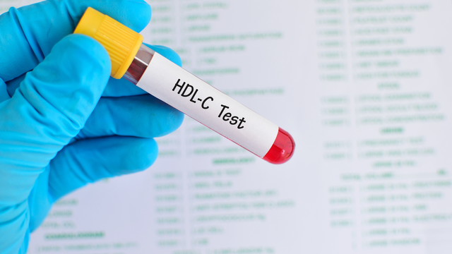 Xét nghiệm HDL-C? Kết quả HDL cholesterol có ý nghĩa gì?