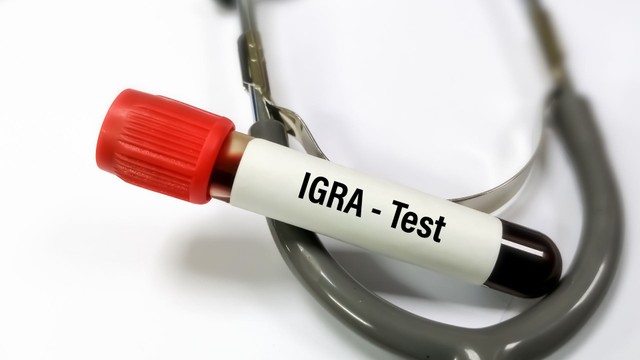 Xét nghiệm IGRA: Ý nghĩa, quy trình và những điều cần biết