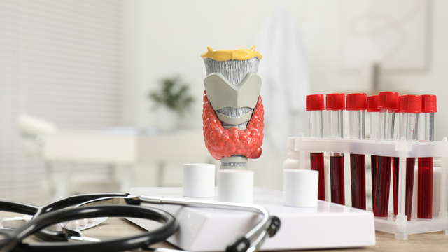 Xét nghiệm máu tuyến giáp bao nhiêu tiền? Khi nào cần xét nghiệm máu tuyến giáp?