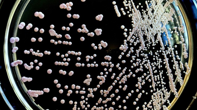 Xét nghiệm nấm Candida gồm những gì? Những thông tin cần biết