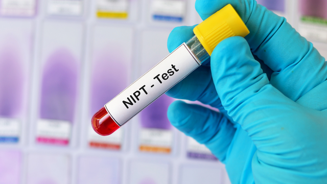 Xét nghiệm NIPT biết được những gì? Khi nào cần thực hiện?