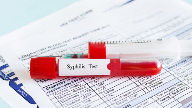 Xét nghiệm Syphilis là gì? Các loại xét nghiệm Syphilis và quy trình thực hiện