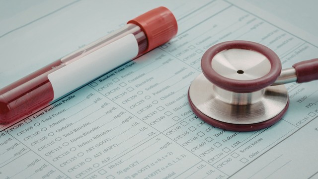 Xét nghiệm TCK là gì? Vai trò trong rối loạn đông máu