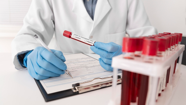 Xét nghiệm thiếu máu thiếu sắt: Quy trình, ý nghĩa và khi nào cần thực hiện?