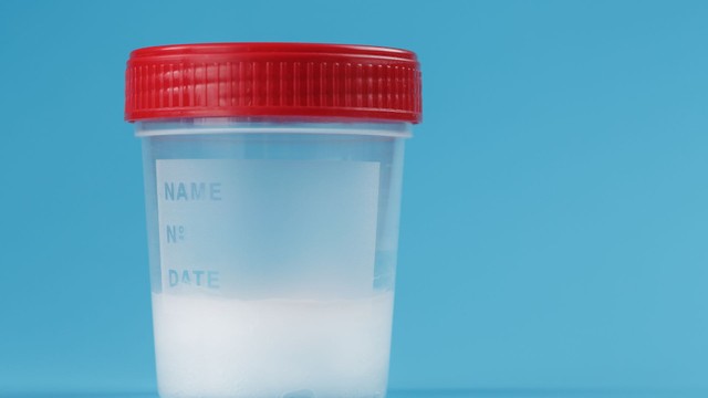 Xét nghiệm tinh dịch đồ ở đâu TPHCM để đảm bảo an toàn?